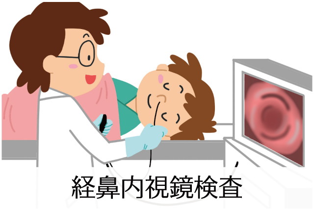 経鼻内視鏡検査