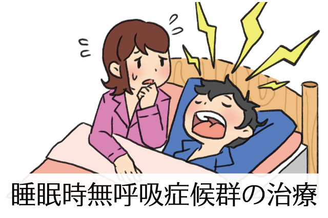 睡眠時無呼吸症候群の治療