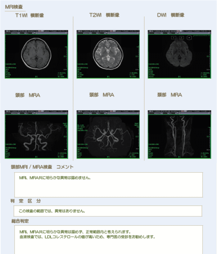 脳ドック検査報告書02